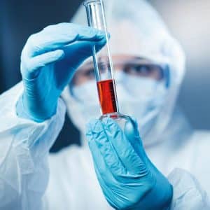 Medewerker in laboratorium met medische handschoenen voor bescherming tegen chemicaliën